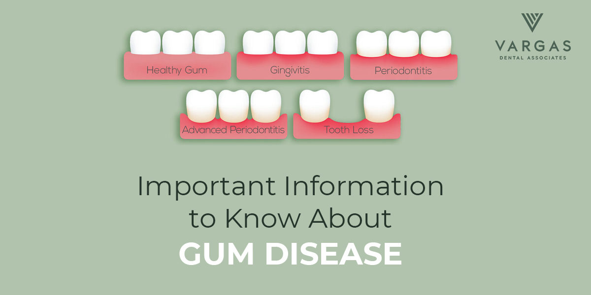 Blog – Vargas -important information to know about gum disease – 1200 x 630