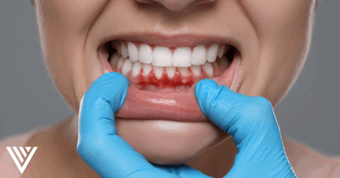 Vargas Blog August 2025